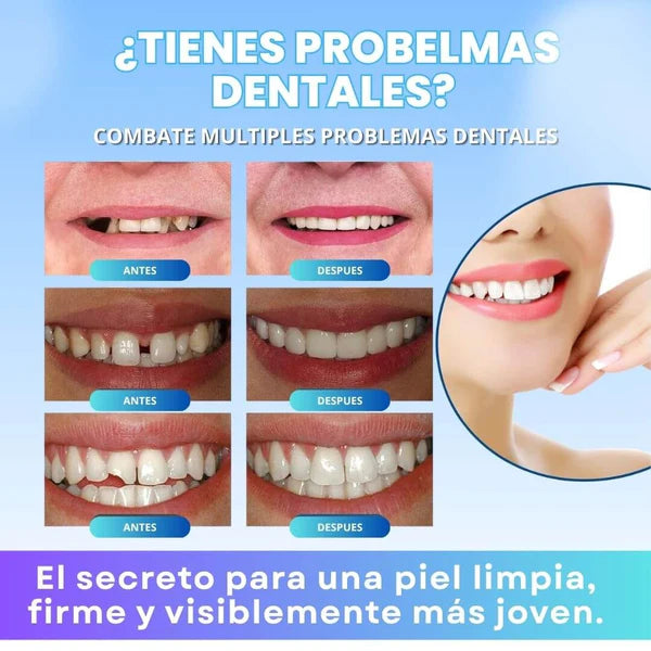 Dientes postizos moldeables (promocion 2x1🎁)